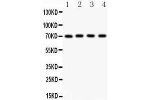 Western Blotting (WB) image for anti-Neuregulin 1 (NRG1) (AA 2-241) antibody (ABIN3043580)