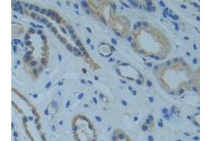 Detection of SMAD9 in Human Kidney Tissue using Polyclonal Antibody to SMAD family member 9 (SMAD9)