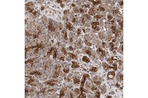 Immunohistochemical staining of human pancreas with PVRL1 polyclonal antibody  shows strong cytoplasmic and membranous positivity in intercalated ducts at 1:50-1:200 dilution. (PVRL1 anticorps)