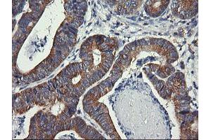 Image no. 2 for anti-Dynamin 1-Like (DNM1L) antibody (ABIN1497872)