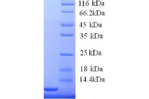 SDS-PAGE (SDS) image for High Affinity Immunoglobulin epsilon Receptor Subunit gamma (FCER1G) (AA 45-86), (Cytoplasmic Domain), (Cytosolic) protein (His tag) (ABIN5713448)