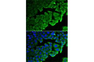 Immunofluorescence analysis of HeLa cells using RPLP0 antibody (ABIN6128686, ABIN6147163, ABIN6147165 and ABIN6221205). (RPLP0 anticorps  (AA 1-317))