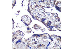 Immunohistochemistry of paraffin-embedded Human placenta using PASK Rabbit pAb (ABIN6128413, ABIN6145248, ABIN6145249 and ABIN6224850) at dilution of 1:100 (40x lens). (PASK anticorps  (AA 1194-1323))
