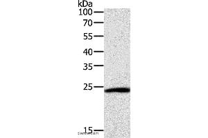 Western blot analysis of Hela cell, using SNAP25 Polyclonal Antibody at dilution of 1:400 (SNAP25 anticorps)