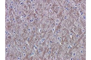 Immunohistochemical staining of rat brain tissue using anti-VEGF antibody  A. (Recombinant VEGF anticorps)