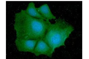ICC/IF analysis of IDH1 in Hep3B cells line, stained with DAPI (Blue) for nucleus staining and monoclonal anti-human IDH1 antibody (1:100) with goat anti-mouse IgG-Alexa fluor 488 conjugate (Green). (IDH1 anticorps  (AA 1-414))