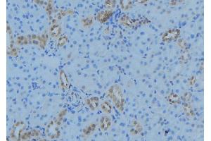 ABIN6279071 at 1/100 staining Mouse kidney tissue by IHC-P. (ACOT9 anticorps  (Internal Region))