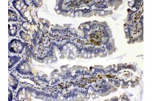 IHC analysis of Calpain 2 using anti-Calpain 2 antibody .