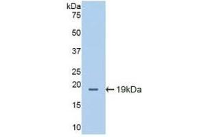 Detection of Recombinant ICAM1, Mouse using Polyclonal Antibody to Intercellular Adhesion Molecule 1 (ICAM1)