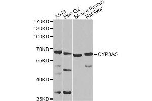Western blot analysis of extracts of various cell lines, using CYP3A5 Antibody (ABIN2736613) at 1:1000 dilution.
