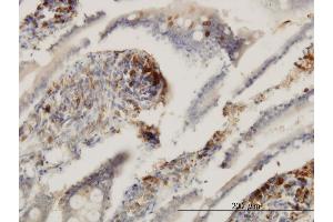 Immunoperoxidase of monoclonal antibody to ENTPD6 on formalin-fixed paraffin-embedded human small Intestine.