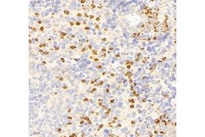 Immunohistochemistry of paraffin embedded mouse Immune spleen using IL-23R (ABIN7074355) at dilution of 1:200 (400x lens)
