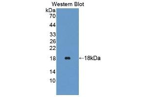 Detection of Recombinant TRAPPC2, Human using Polyclonal Antibody to Trafficking Protein Particle Complex 2 (TRAPPC2) (TRAPPC2 anticorps  (AA 1-140))