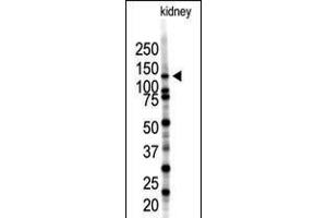 Western blot analysis of SENP7 polyclonal antibody in mouse kidney tissue lysate (35ug/lane). (SENP7 anticorps  (C-Term))