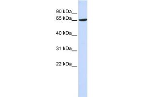 WB Suggested Anti-ADAM9 Antibody Titration:  0. (ADAM9 anticorps  (Middle Region))
