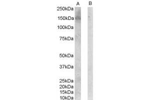 ABIN185461 (0. (ERBB3 anticorps  (C-Term))