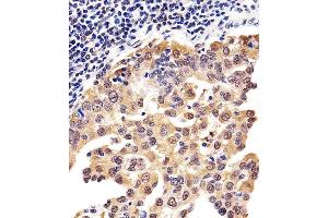 Immunohistochemical analysis of paraffin-embedded H. (PSMD10 anticorps  (AA 43-76))