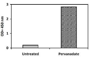 Tyrosine Kinase 2 (TYK2) ELISA Kit