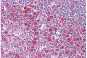 Human Tonsil: Formalin-Fixed, Paraffin-Embedded (FFPE)