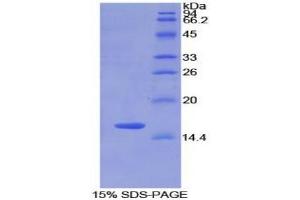 SDS-PAGE analysis of Rat Matrix Gla Protein. (MGP Protéine)