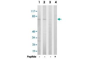 Western blot analysis of extracts from HeLa cells (Lane 1), Jurkat cells (Lane 2) and COLO 205 cells (Lane 3 and lane 4), using HKR1 polyclonal antibody . (HKR1 anticorps)