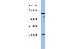 WB Suggested Anti-FAIM  Antibody Titration: 0. (FAIM anticorps  (Middle Region))