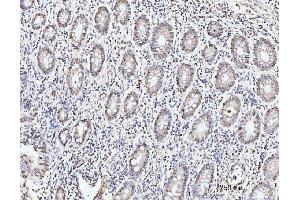 IHC analysis of KIFC1 using anti-KIFC1 antibody (ABIN7599523). (KIFC1 anticorps  (AA 1-673))