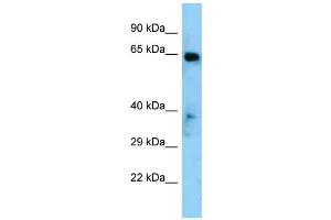 Western Blotting (WB) image for anti-Eyes Absent Homolog 1 (EYA1) (Middle Region) antibody (ABIN2779641) (EYA1 anticorps  (Middle Region))