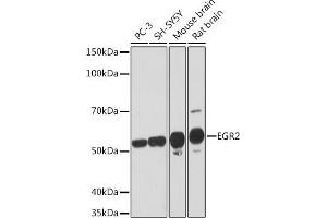 Western blot analysis of extracts of various cell lines, using EGR2 Rabbit mAb (ABIN1682321, ABIN7101509, ABIN7101510 and ABIN7101511) at 1:1000 dilution. (EGR2 anticorps)