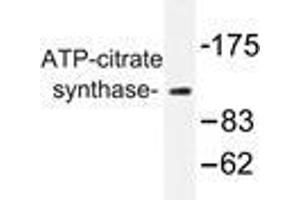 Western blot analysis of ATP-citrate synthase antibody in extracts from COS7 cells. (ACLY anticorps)