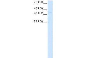 WB Suggested Anti-CTDSPL Antibody Titration:  0. (CTDSPL anticorps  (N-Term))