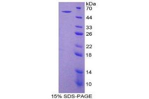 SDS-PAGE (SDS) image for Ectonucleoside Triphosphate diphosphohydrolase 1 (ENTPD1) (AA 213-452) protein (His tag,GST tag) (ABIN2122763)
