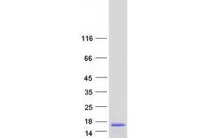 Validation with Western Blot
