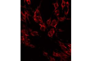 ABIN6268687 staining HeLa by IF/ICC. (IL2 Receptor beta anticorps  (N-Term))