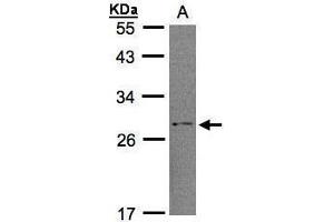 WB Image Sample (30μg whole cell lysate) A:H1299 12% SDS PAGE antibody diluted at 1:1000 (RGS2 anticorps)