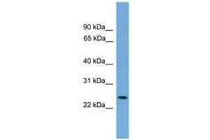 Image no. 1 for anti-Proteasome (Prosome, Macropain) Activator Subunit 2 (PA28 Beta) (PSME2) (AA 143-192) antibody (ABIN6746452) (PSME2 anticorps  (AA 143-192))