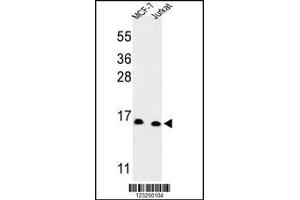 Western blot analysis of SNRPD3 Antibody in MCF-7, Jurkat cell line lysates (35ug/lane)