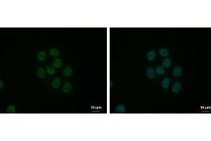 ICC/IF Image SFRS9 antibody detects SFRS9 protein at nucleus by immunofluorescent analysis. (SFRS9 anticorps  (Center))