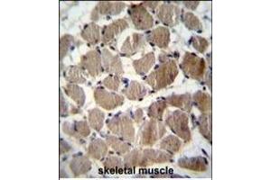 COCH Antibody (Center) (ABIN656833 and ABIN2846042) immunohistochemistry analysis in formalin fixed and paraffin embedded human skeletal muscle followed by peroxidase conjugation of the secondary antibody and DAB staining. (COCH anticorps  (AA 399-428))