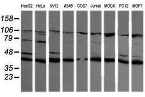 Image no. 5 for anti-Mitogen-Activated Protein Kinase Kinase 1 (MAP2K1) antibody (ABIN1499375) (MEK1 anticorps)