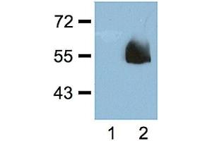 1:1000 (1 ug/ml) antibody dilution probed against HEK 293 cells transfected with HA-tagged protein vector; unstransfected (1) and transfected (2). (Hemagglutinin anticorps)
