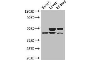 Western Blot Positive WB detected in: Mouse heart tissue, Mouse liver tissue, Mouse kidney tissue All lanes: TGIF1 antibody at 3 μg/mL Secondary Goat polyclonal to rabbit IgG at 1/50000 dilution Predicted band size: 44, 30, 32, 28 kDa Observed band size: 44, 50 kDa (TGIF1 anticorps  (AA 8-375))