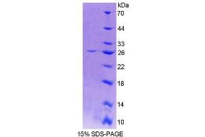 SDS-PAGE (SDS) image for Cathepsin O (CTSO) (AA 111-317) protein (His tag) (ABIN6239532) (CTSO Protein (AA 111-317) (His tag))
