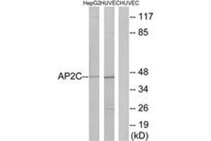 Western blot analysis of extracts from HepG2/HuvEc cells, using AP2C Antibody. (TFAP2C anticorps  (AA 401-450))