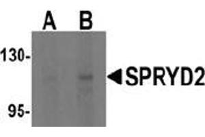 Western blot analysis of SPRYD2 in rat brain tissue lysate with SPRYD2 antibody at (A) 1 and (B) 2 μg/ml (CMYA5 anticorps  (C-Term))