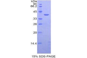 SDS-PAGE (SDS) image for Calcitonin (Calca) (AA 26-136) protein (His tag) (ABIN3209877)