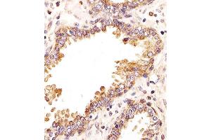 Immunohistochemical analysis of paraffin-embedded H.