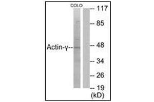 Western blot analysis of extracts from COLO205 cells, using Actin-gamma2 Antibody. (ACTG2 anticorps  (N-Term))