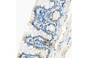 Immunohistochemistry of paraffin embedded rat colon using Cdcp1 (ABIN7073600) at dilution of 1:300 (400x lens) (CDCP1 anticorps)