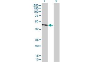 Western Blot analysis of UQCRC2 expression in transfected 293T cell line by UQCRC2 MaxPab polyclonal antibody. (UQCRC2 anticorps  (AA 1-453))
